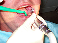 Генетики предложили новый метод лечения болезней зубов